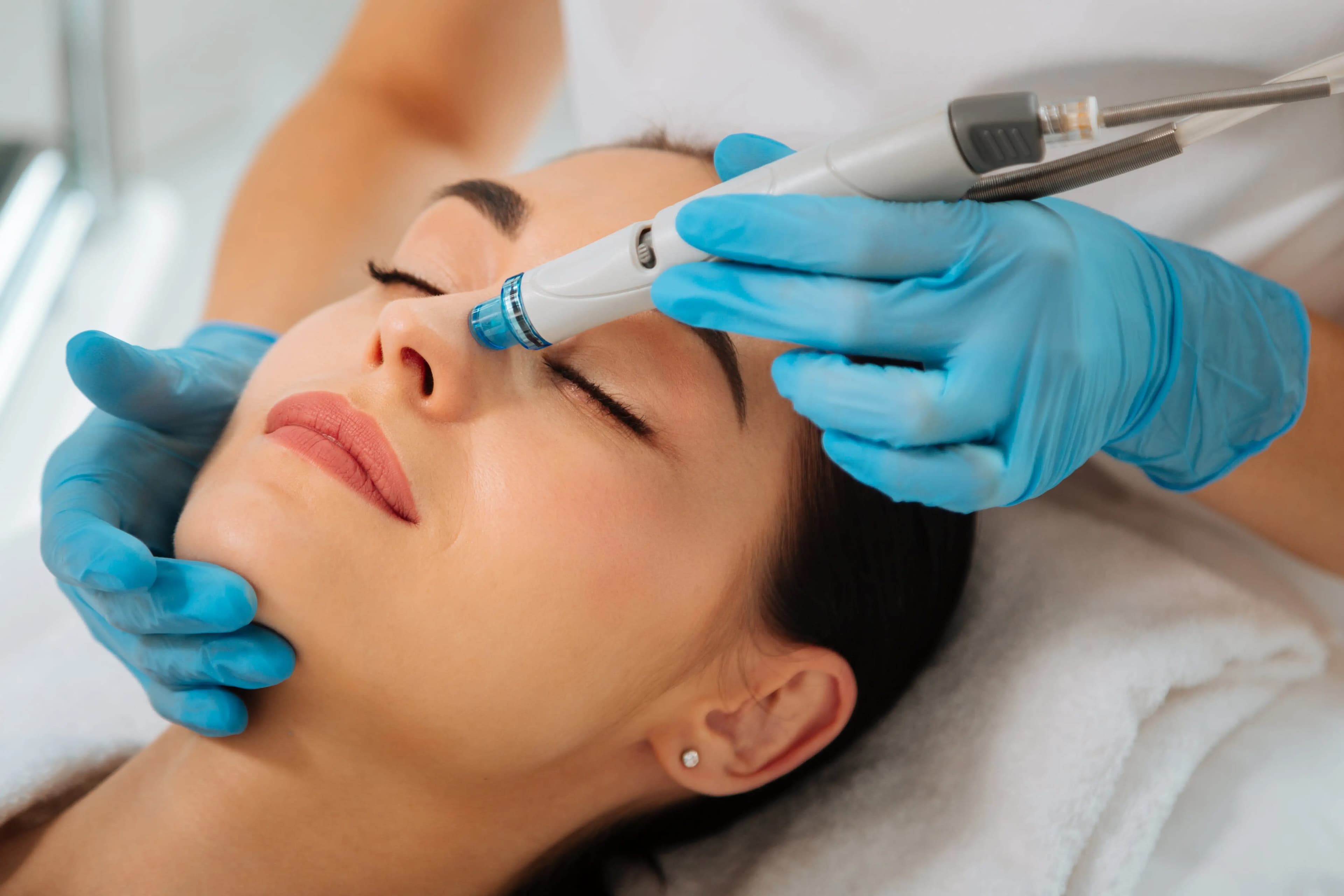 Benefits of Undergoing HydraFacial