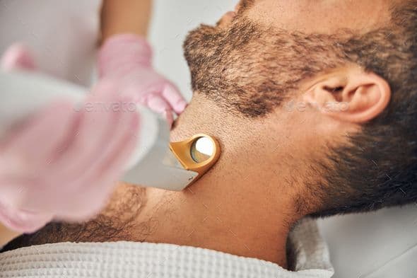 Beard Shaping Laser Hair Removal for Men