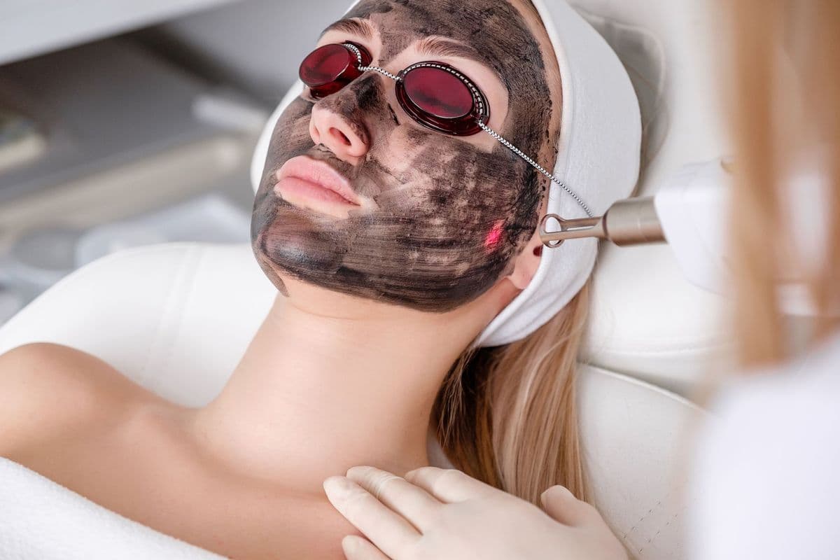 Carbon Laser Facial for Women