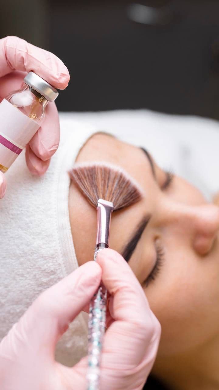 Chemical Peel For Women