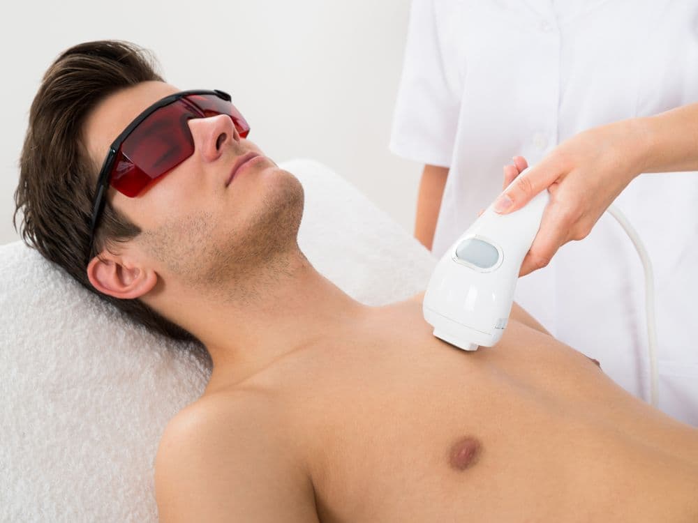 Chest Laser Hair Removal For Men