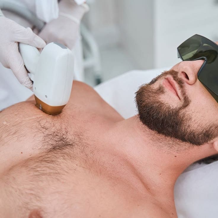 Lower Body Laser Hair Removal For Men