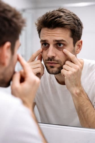Under Eye Chemical Peel For Men