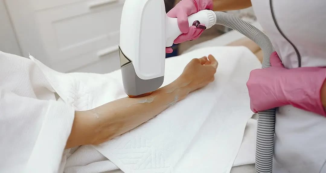 Laser Hair Treatment - Type 2