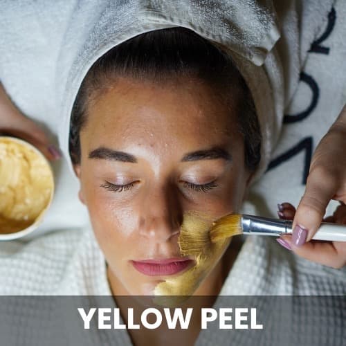 Yellow Peel Treatment