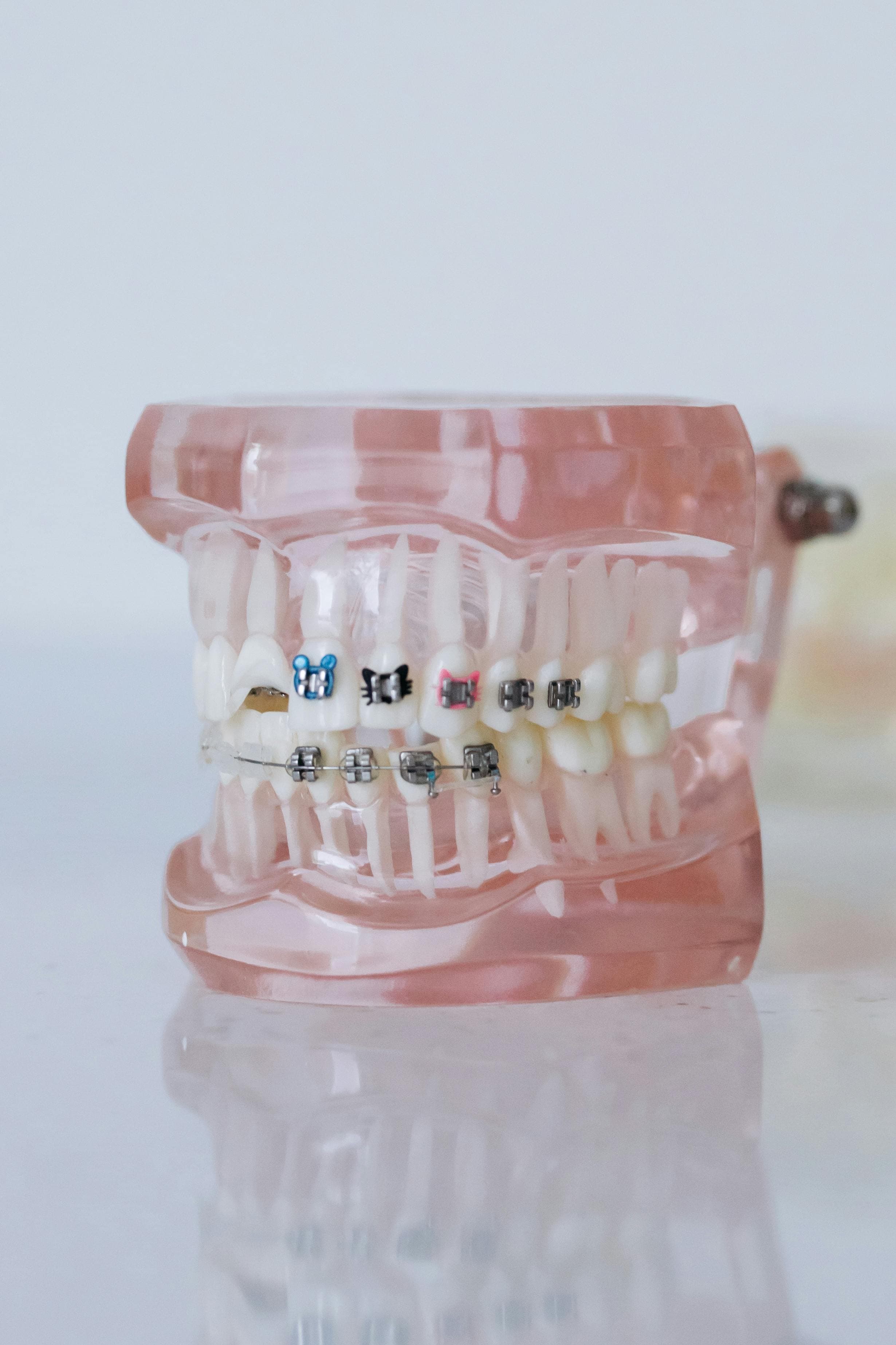Teeth aligner
