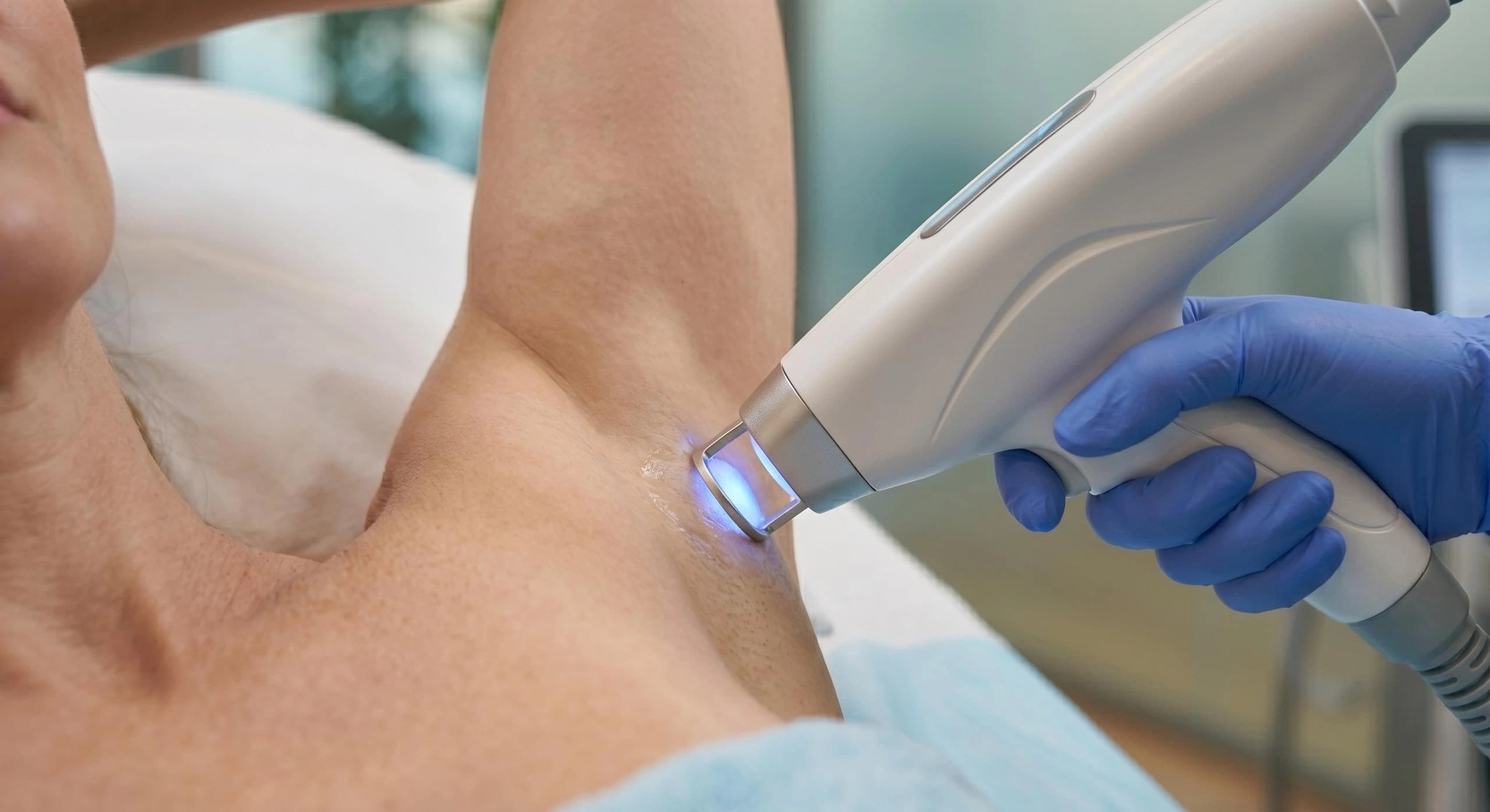 Under Arms laser Hair Removal For Women 2