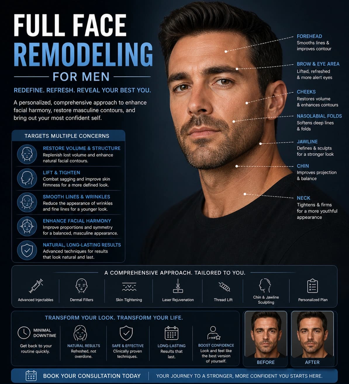 Full Face Remodeling For Men