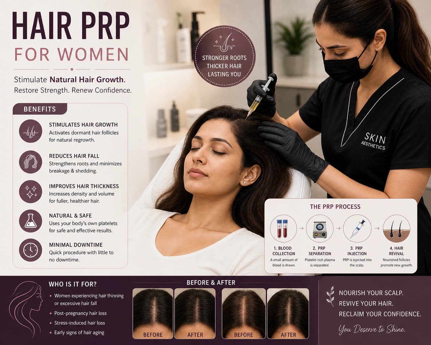 Hair PRP For Women