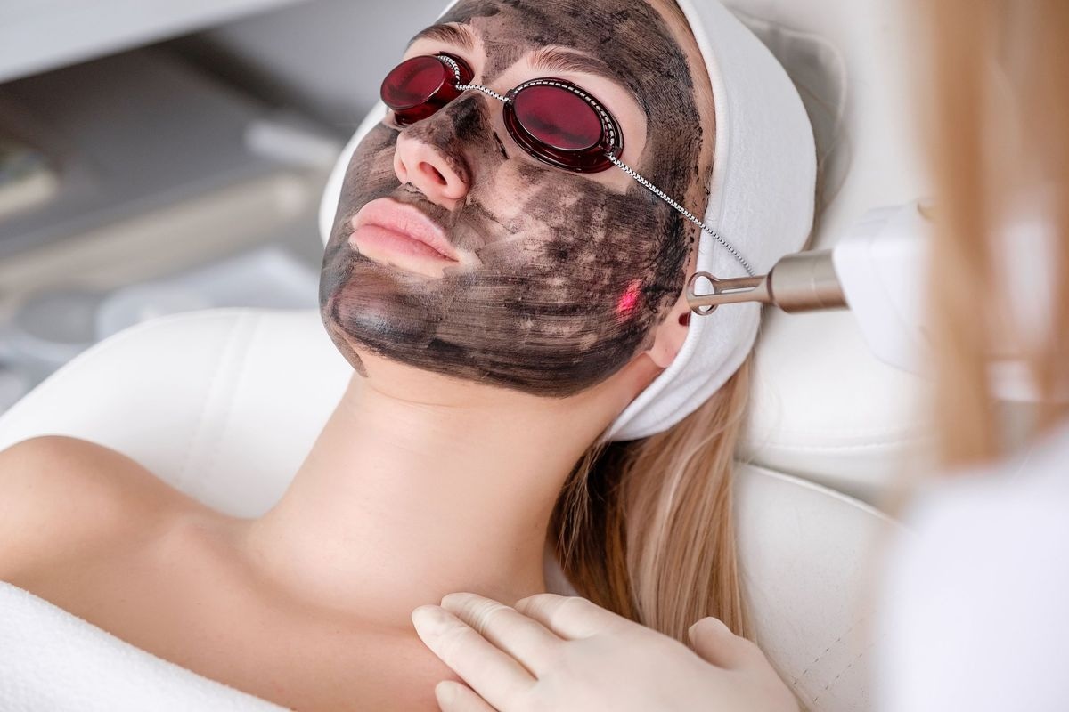 Carbon Laser Facial for Women