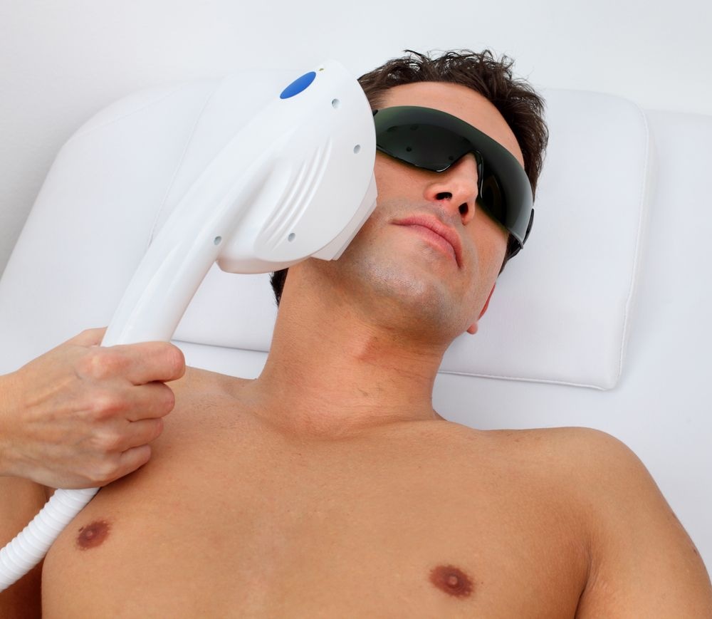 Laser Hair Removal for Men