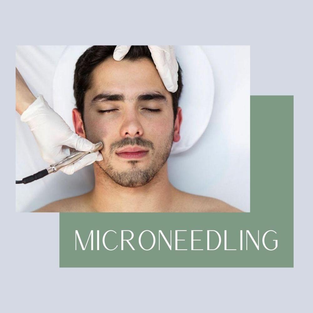 Microneedling for Men and Women