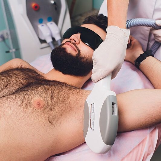 Under Arms Laser Hair Removal for Men