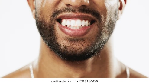 Teeth Veneers