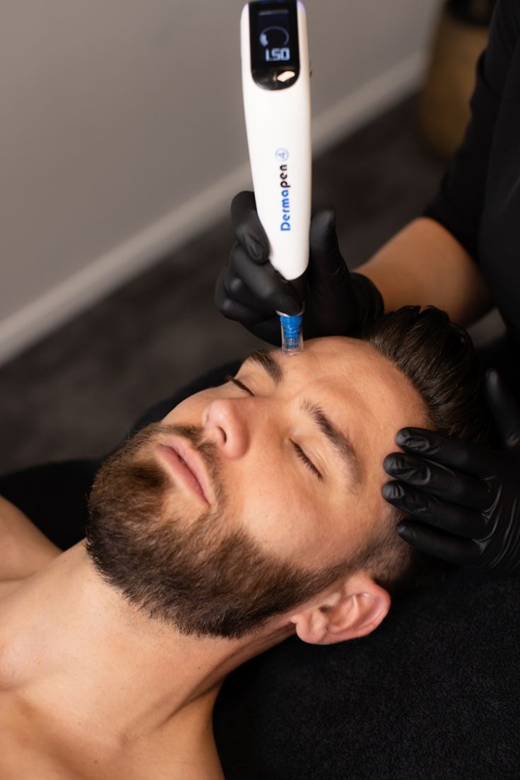 Carbon Laser Hollywood Facial For Men
