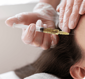 Full Face Laser Hair Reduction