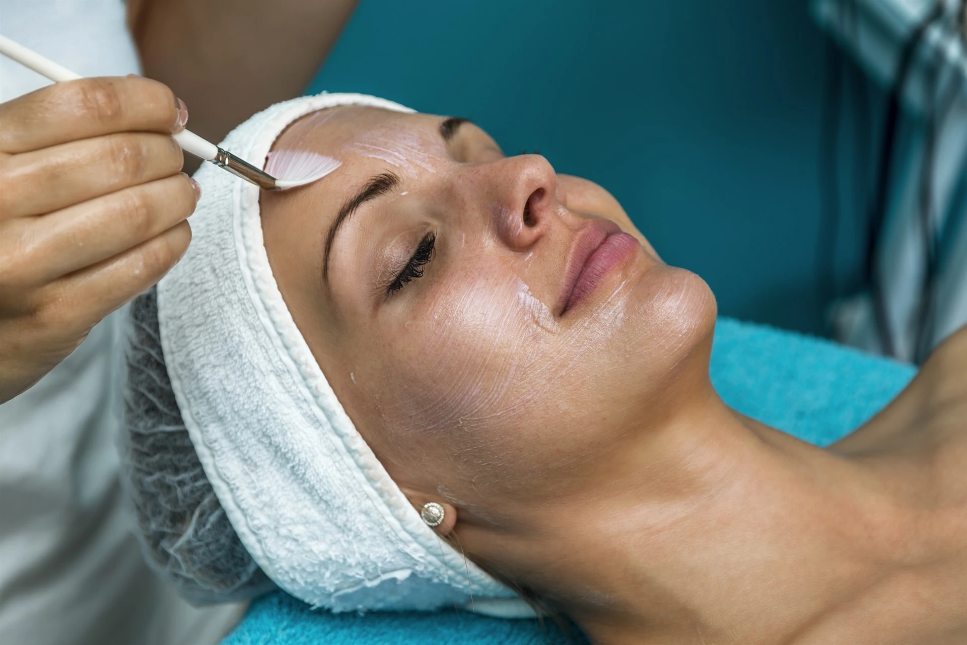 Chemical Peel Treatment: Types, Benefits & Results