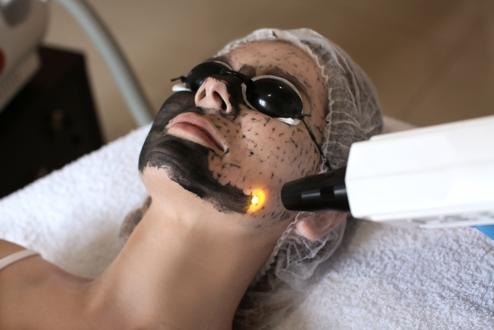 Carbon Laser Facial Cost: What Affects Pricing?