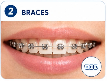 Braces