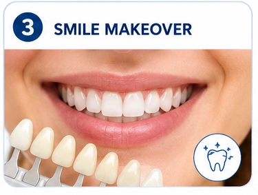 Smile Makeover