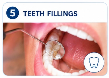 Teeth Fillings
