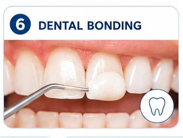 Dental Bonding