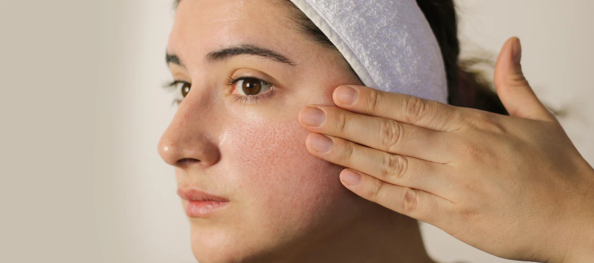 Open Pores: Why You Have Them and How to Minimise Them