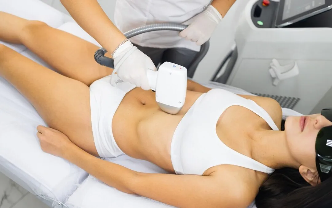 Laser Hair Reduction for Women: Full Body vs Targeted Areas