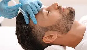 Hair Mesotherapy: What's in the Cocktail and How It Works