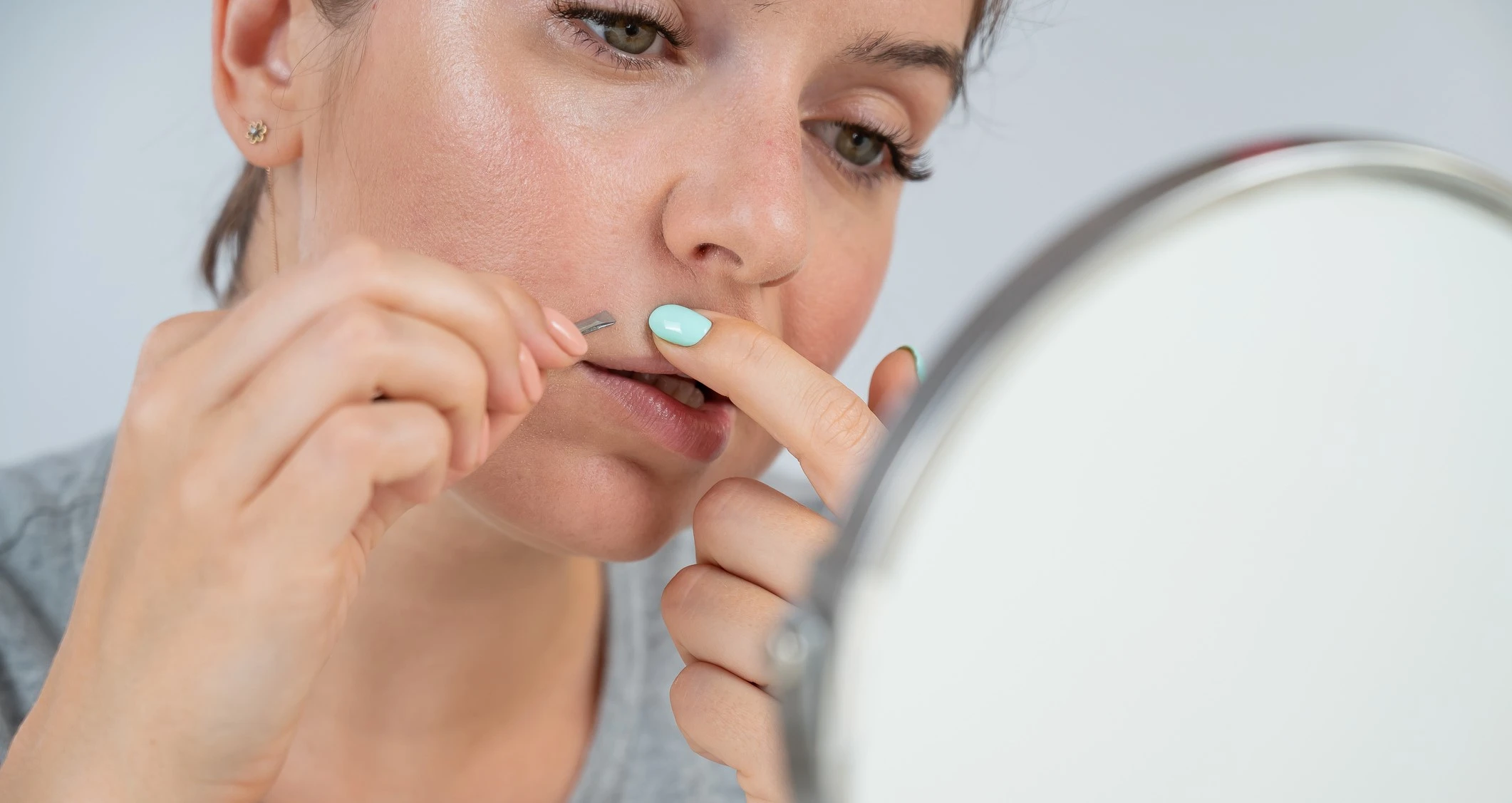 Unwanted Facial Hair in Women: Causes and Permanent Solutions