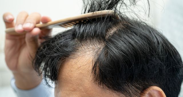 Hair GFC For Men